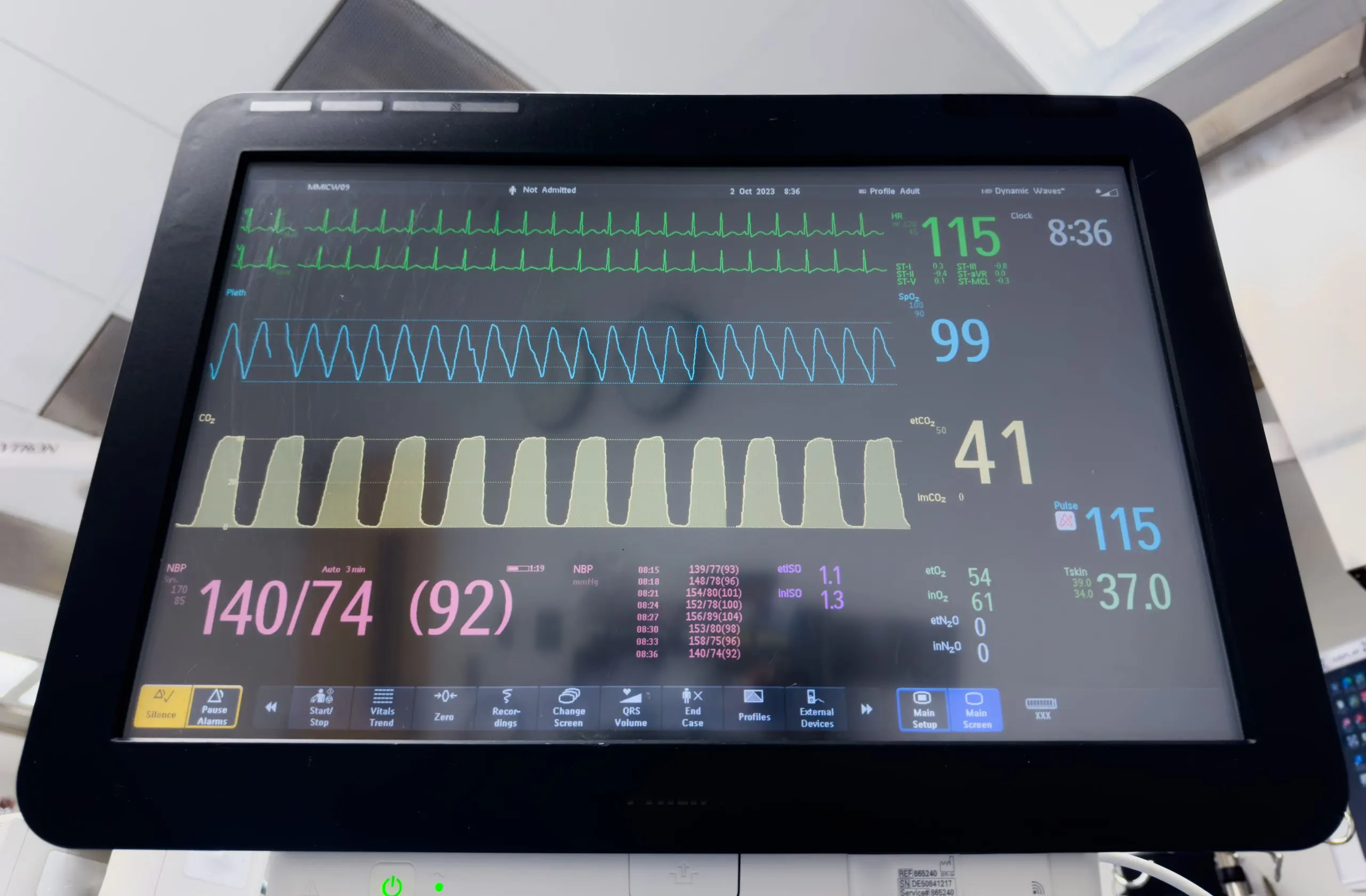 India ECG Machines Market Outlook to 2030 India-ECG-Machines-Market-scaled