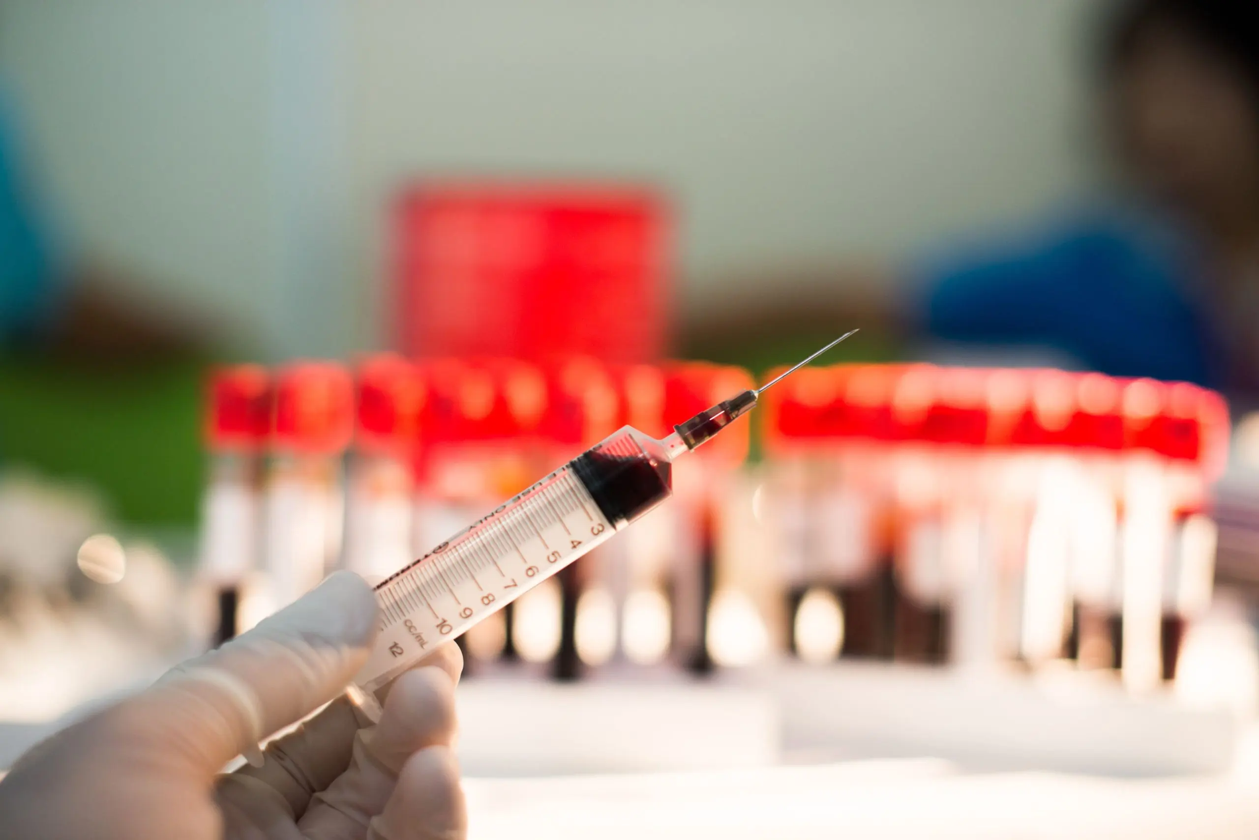 India Therapeutic Apheresis Market Outlook to 2030 India-Therapeutic-Apheresis-Market-scaled