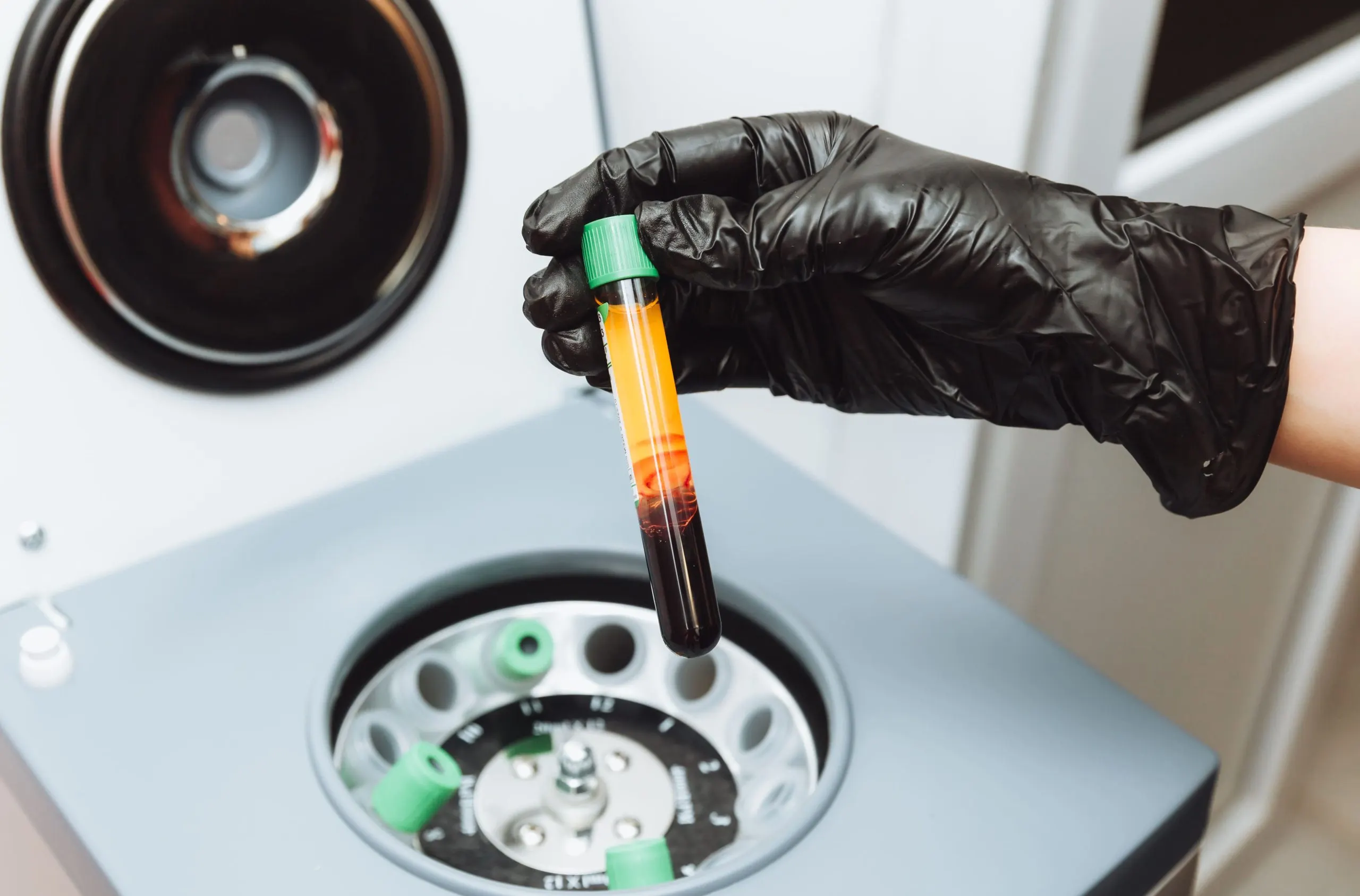 Singapore Centrifuges Market Outlook to 2030 Singapore-Centrifuges-Market-scaled